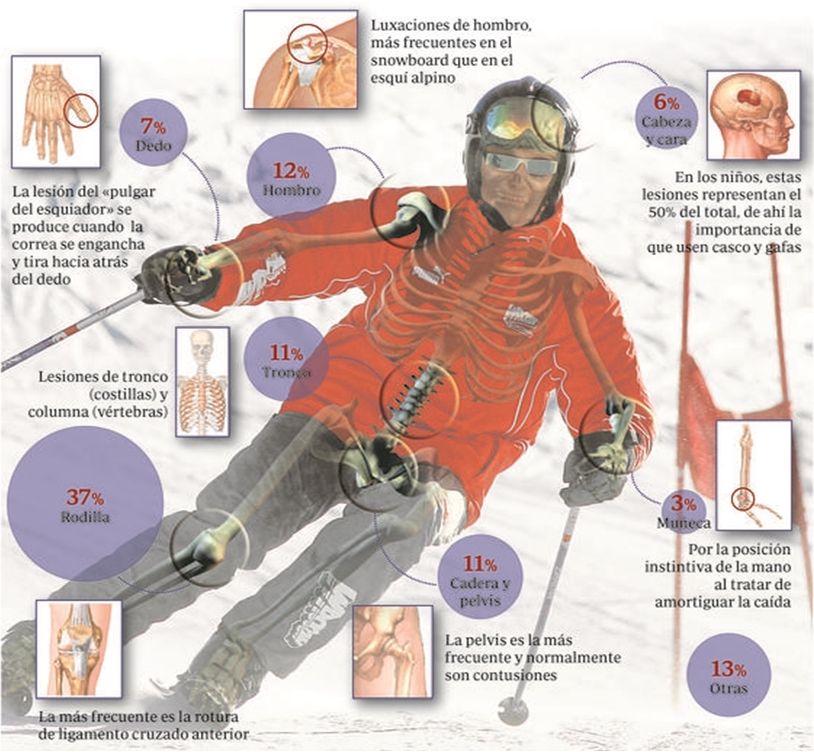 La Temporada de Esquí, La Rodilla sus lesiones y su tratamiento mediante fisioterapia, osteopatía y Pilates